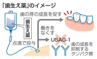 世界初の「歯生え薬」治験開始へ　子ども向け、30年実用化目指す