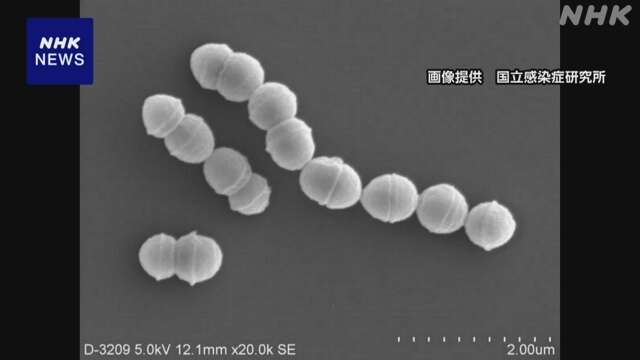 「劇症型溶血性レンサ球菌感染症」報告 過去最多ペースで増加