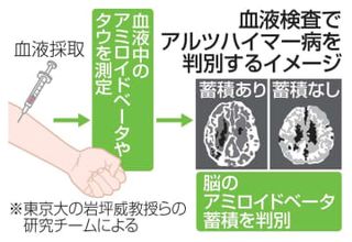 血液検査で認知症判別　無症状、早期の診断期待