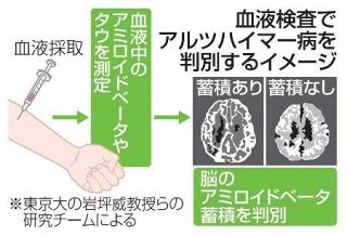 血液検査で認知症判別　無症状、早期の診断期待