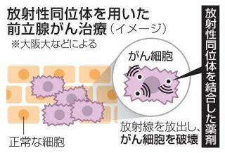 前立腺がん治験開始へ、大阪大　国内製造可能な放射性同位体で