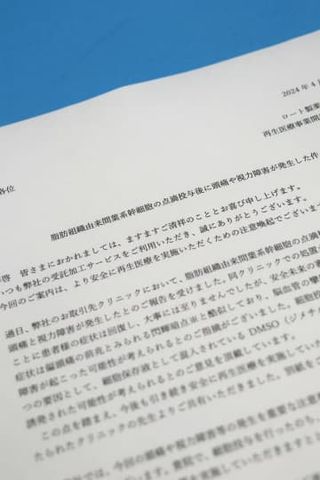 再生医療後に一時視力障害　ロート製造細胞、注意喚起