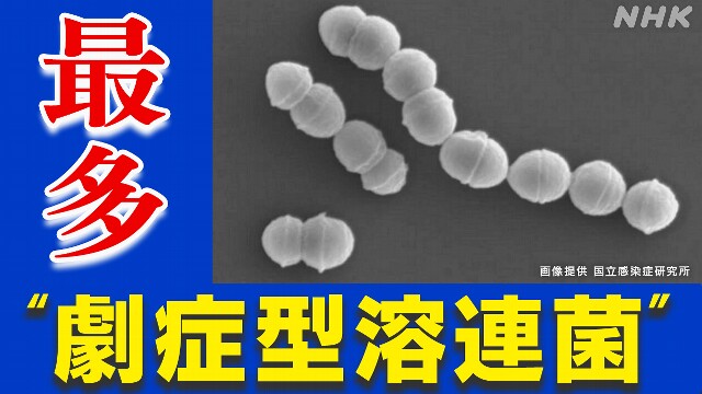 「劇症型溶血性レンサ球菌感染症」ことしの患者数 過去最多に