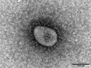 米、コロナ後遺症に定義　「症状３カ月」共通化図る