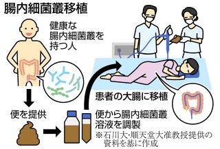 ＜フロンティア発＞がん治療試験　使うは「便」