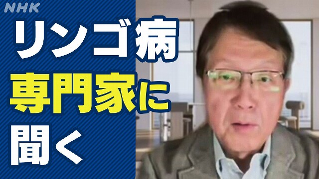 患者が増えている「リンゴ病」 治療法は？妊婦の対策は？