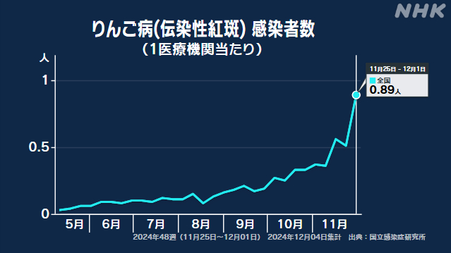 リンゴ病の患者数 前週から大幅増 妊婦の初感染で胎児に影響も